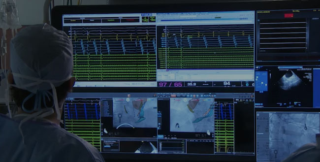 What is an Electrophysiology Laboratory or EP Lab? Where is an AFib ablation performed?