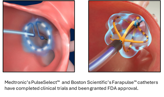 Pulsed Field Ablation: A New Paradigm in the Treatment of Atrial Fibrillation!